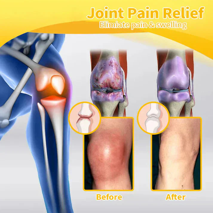⭐️Jhati® Bee Venom Instant Ultra Strength Pain Relief Therapy Cream