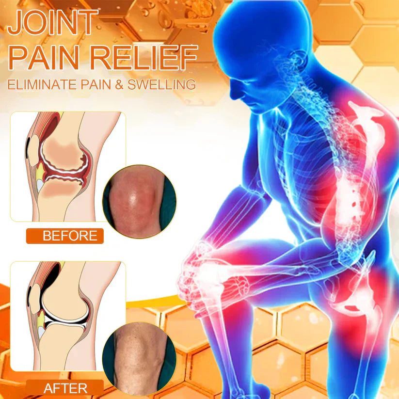 ⭐️Jhati® Bee Venom Instant Ultra Strength Pain Relief Therapy Cream