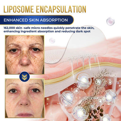 ⭐️Jhati® MicroNeedle Liposome Glutathione Melanin Removal Patches