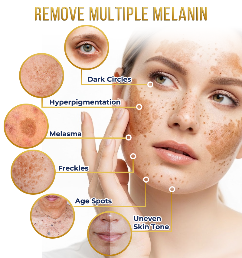 ⭐️Jhati® MicroNeedle Liposome Glutathione Melanin Removal Patches