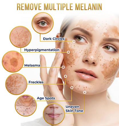 Jhati® MicroNeedle & Melazero V2 Dark Spot Brightening Cream