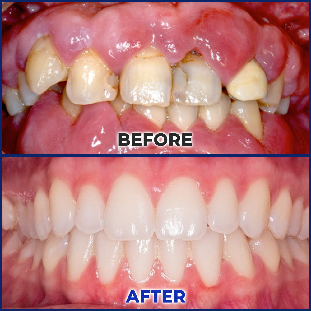 🥇Rolimey® BeeTakt Bee Venom Dental Treatment Drops Mouthwash