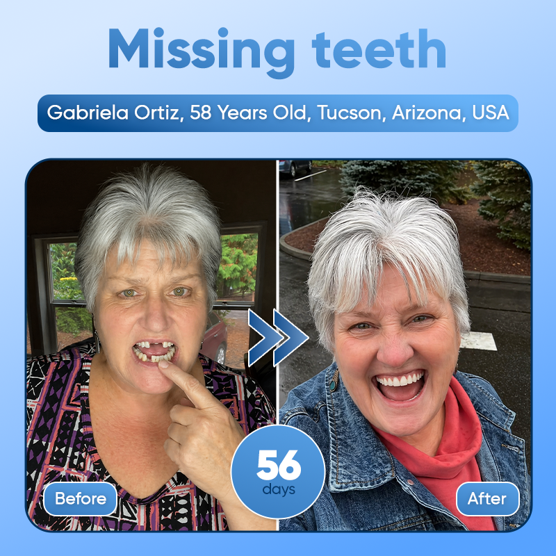 Your Smile~🦷Tideglusib Fast‑Dissolving Tooth & Gum Repair Oral Strips✨ (𝟓-𝐢𝐧-𝟏 💎 𝐑𝐞𝐛𝐮𝐢𝐥𝐝 𝐄𝐧𝐚𝐦𝐞𝐥 & 𝐃𝐞𝐧𝐭𝐢𝐧 • 𝐒𝐭𝐫𝐞𝐧𝐠𝐭𝐡𝐞𝐧 𝐆𝐮𝐦𝐬 • 𝐄𝐫𝐚𝐝𝐢𝐜𝐚𝐭𝐞 𝐓𝐚𝐫𝐭𝐚𝐫 & 𝐎𝐝𝐨𝐫 • 𝐖𝐡𝐢𝐭𝐞𝐧𝐢𝐧𝐠 • 𝐒𝐭𝐨𝐩 𝐓𝐨𝐨𝐭𝐡 𝐒𝐞𝐧𝐬𝐢𝐭𝐢𝐯𝐢𝐭𝐲)