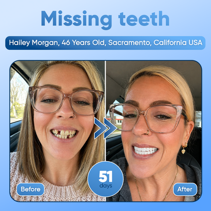 Your Smile😁Tideglusib Fast‑Dissolving Tooth & Gum Repair Oral Strips🦷✨ (𝟓-𝐢𝐧-𝟏 💎 𝐑𝐞𝐛𝐮𝐢𝐥𝐝 𝐄𝐧𝐚𝐦𝐞𝐥 & 𝐃𝐞𝐧𝐭𝐢𝐧 • 𝐒𝐭𝐫𝐞𝐧𝐠𝐭𝐡𝐞𝐧 𝐆𝐮𝐦𝐬 • 𝐄𝐫𝐚𝐝𝐢𝐜𝐚𝐭𝐞 𝐓𝐚𝐫𝐭𝐚𝐫 & 𝐎𝐝𝐨𝐫 • 𝐖𝐡𝐢𝐭𝐞𝐧𝐢𝐧𝐠 • 𝐒𝐭𝐨𝐩 𝐓𝐨𝐨𝐭𝐡 𝐒𝐞𝐧𝐬𝐢𝐭𝐢𝐯𝐢𝐭𝐲) (Copy)