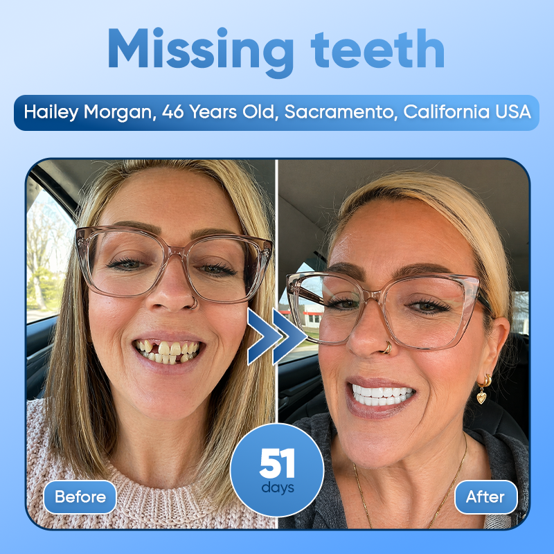 ⭐️Tideglusib Fast‑Dissolving Tooth & Gum Repair Oral Strips