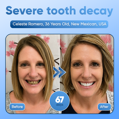 Your Smile~🦷Tideglusib Fast‑Dissolving Tooth & Gum Repair Oral Strips✨ (𝟓-𝐢𝐧-𝟏 💎 𝐑𝐞𝐛𝐮𝐢𝐥𝐝 𝐄𝐧𝐚𝐦𝐞𝐥 & 𝐃𝐞𝐧𝐭𝐢𝐧 • 𝐒𝐭𝐫𝐞𝐧𝐠𝐭𝐡𝐞𝐧 𝐆𝐮𝐦𝐬 • 𝐄𝐫𝐚𝐝𝐢𝐜𝐚𝐭𝐞 𝐓𝐚𝐫𝐭𝐚𝐫 & 𝐎𝐝𝐨𝐫 • 𝐖𝐡𝐢𝐭𝐞𝐧𝐢𝐧𝐠 • 𝐒𝐭𝐨𝐩 𝐓𝐨𝐨𝐭𝐡 𝐒𝐞𝐧𝐬𝐢𝐭𝐢𝐯𝐢𝐭𝐲)