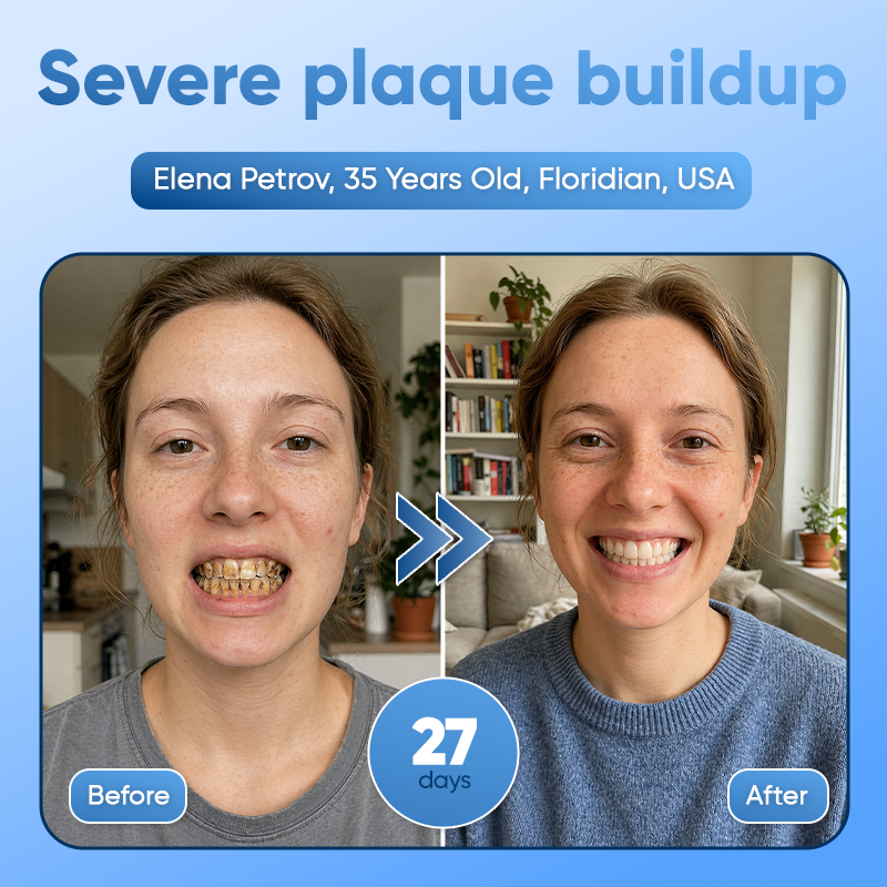 Your Smile~🦷Tideglusib Fast‑Dissolving Tooth & Gum Repair Oral Strips✨ (𝟓-𝐢𝐧-𝟏 💎 𝐑𝐞𝐛𝐮𝐢𝐥𝐝 𝐄𝐧𝐚𝐦𝐞𝐥 & 𝐃𝐞𝐧𝐭𝐢𝐧 • 𝐒𝐭𝐫𝐞𝐧𝐠𝐭𝐡𝐞𝐧 𝐆𝐮𝐦𝐬 • 𝐄𝐫𝐚𝐝𝐢𝐜𝐚𝐭𝐞 𝐓𝐚𝐫𝐭𝐚𝐫 & 𝐎𝐝𝐨𝐫 • 𝐖𝐡𝐢𝐭𝐞𝐧𝐢𝐧𝐠 • 𝐒𝐭𝐨𝐩 𝐓𝐨𝐨𝐭𝐡 𝐒𝐞𝐧𝐬𝐢𝐭𝐢𝐯𝐢𝐭𝐲)