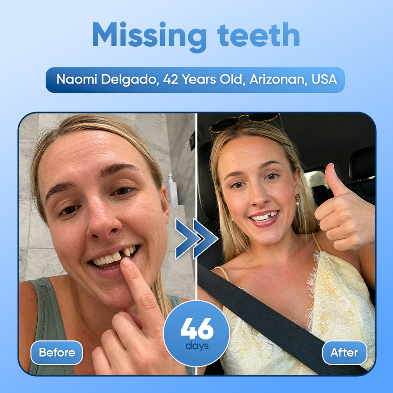 Your Smile~🦷Tideglusib Fast‑Dissolving Tooth & Gum Repair Oral Strips✨ (𝟓-𝐢𝐧-𝟏 💎 𝐑𝐞𝐛𝐮𝐢𝐥𝐝 𝐄𝐧𝐚𝐦𝐞𝐥 & 𝐃𝐞𝐧𝐭𝐢𝐧 • 𝐒𝐭𝐫𝐞𝐧𝐠𝐭𝐡𝐞𝐧 𝐆𝐮𝐦𝐬 • 𝐄𝐫𝐚𝐝𝐢𝐜𝐚𝐭𝐞 𝐓𝐚𝐫𝐭𝐚𝐫 & 𝐎𝐝𝐨𝐫 • 𝐖𝐡𝐢𝐭𝐞𝐧𝐢𝐧𝐠 • 𝐒𝐭𝐨𝐩 𝐓𝐨𝐨𝐭𝐡 𝐒𝐞𝐧𝐬𝐢𝐭𝐢𝐯𝐢𝐭𝐲)