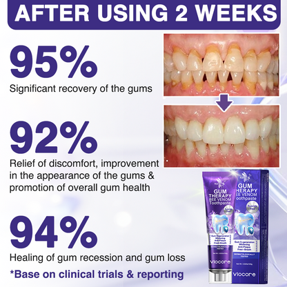 Rolimey® VioCore Bee Venom Dental Treatment Lysozyme Toothpaste🦷